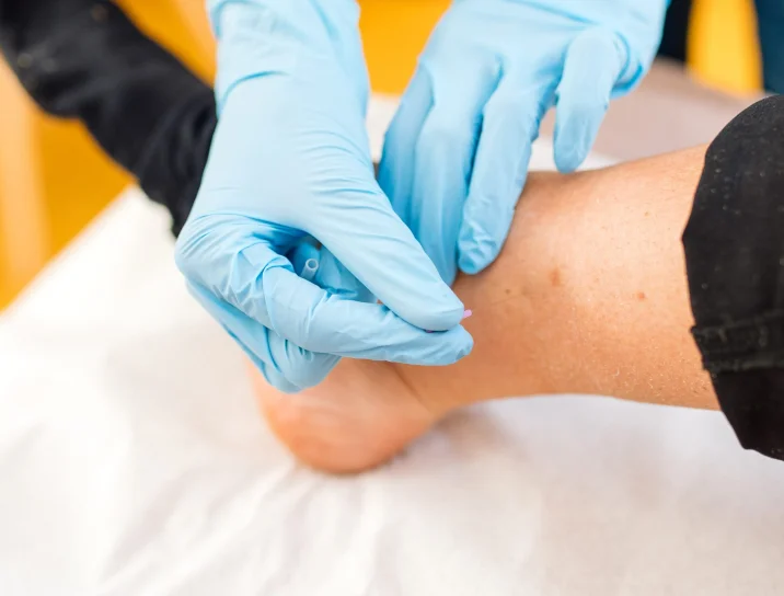 Dry Needling